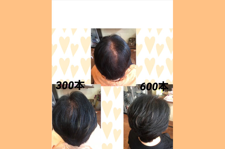 85CF036A-3289-4D78-960B-99C1B11B0DE6